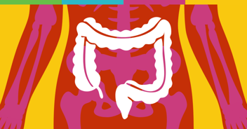 Understanding modern ulcerative colitis through real-world data